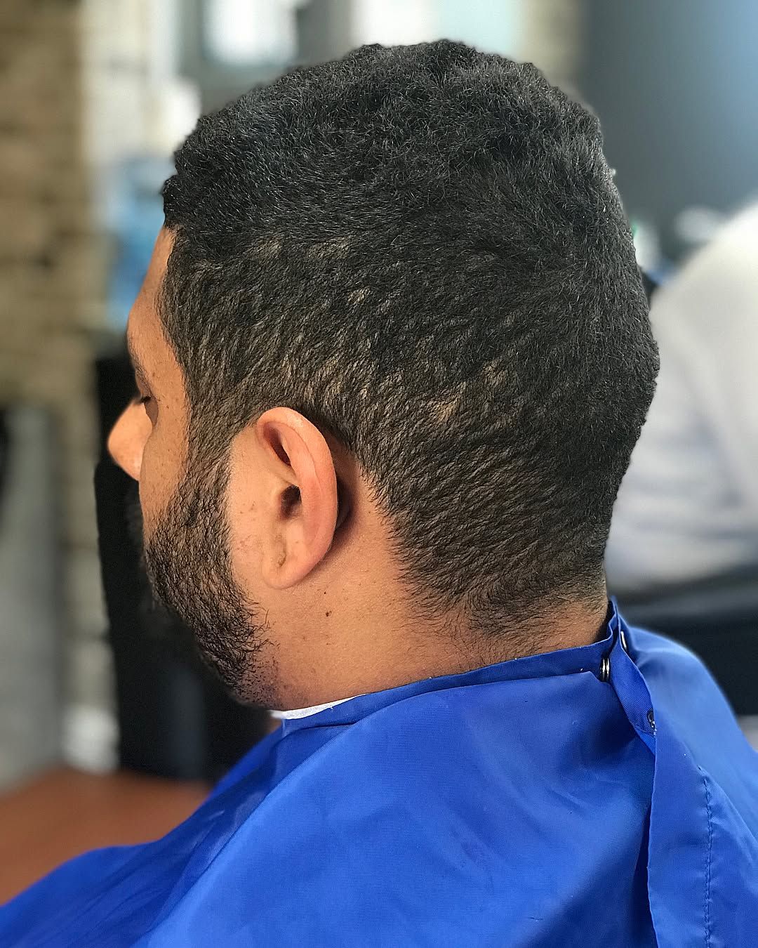 Before and after example - before